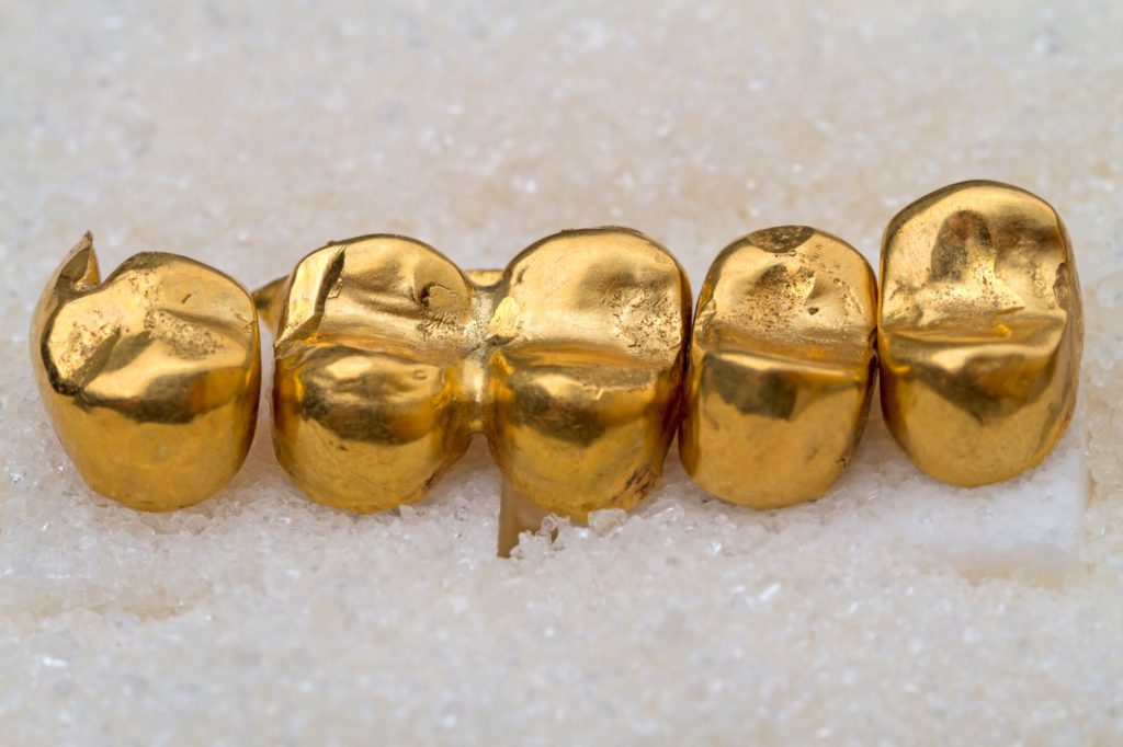 composition de l'or dentaire
